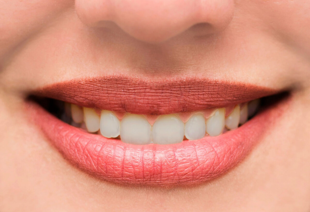 woman-s-lips-and-teeth-smile-close-up3.jpg woman-s-lips-and-teeth-smile-close-up3.jpg